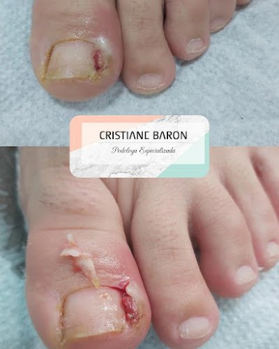 Podóloga Cristiane Baron
